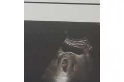 孕4周2天有孕反正常吗