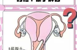 试管婴儿步骤过程图咋看