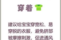 新生儿脐带如何护理