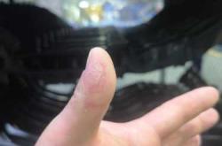 产后手指无力是怎么回事