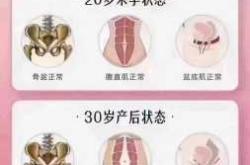 产后修复有必要吗