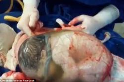 婴儿喝羊水正常吗