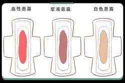 产后子宫有强光点咋办