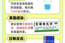 产后脚蜕皮怎么办