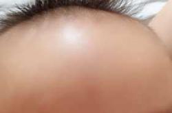 婴儿为何频繁努劲