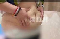 产后肚子松弛是什么样的图片