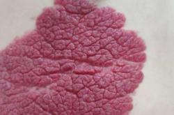 克希劳新生儿有何特别之处