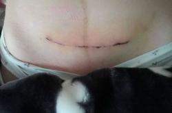 伦敦私立医院剖腹产如何