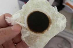 婴儿咳嗽鼻塞怎么办