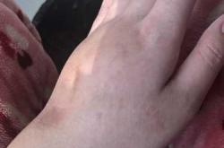 怀孕17周还能打掉孩子吗