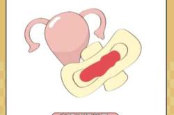 顺产恶露多是怎么回事