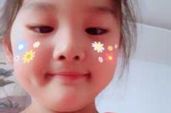 新生儿有梨窝是怎么回事