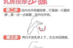 产后奶涨应该如何处理