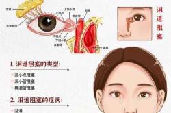 婴儿泪管堵怎么办