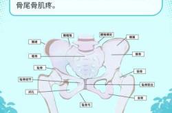 产后尾骨疼多久能恢复