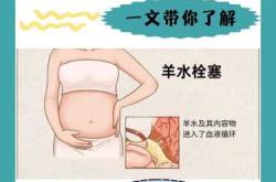 羊水破了还能不能顺产