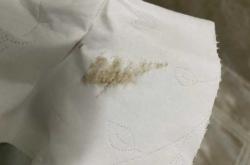 孕42天孕反情况如何