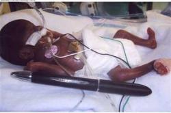 婴儿的新闻有哪些新消息