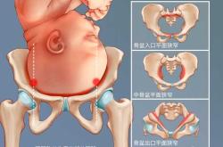 剖腹产和阴道分娩有何不同