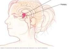 产后大出血原因是什么
