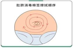 新生儿尿不湿如何护理肚脐
