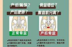 产后产道恢复有哪些要点