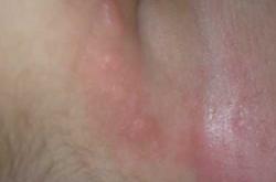 满月婴儿瘦是怎么回事