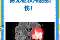 婴儿脑损伤综合症是什么