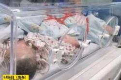 剖腹产两个月怀孕概率有多大