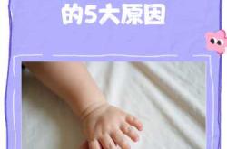 婴儿皮肤干燥脱皮怎么办