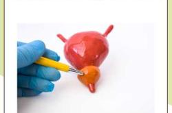 前列腺囊肿会影响备孕吗