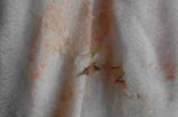 为什么新生儿会呕吐咖啡色液体