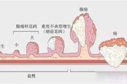 产后阴道口息肉怎么办