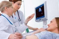 女性高海拔备孕需多久