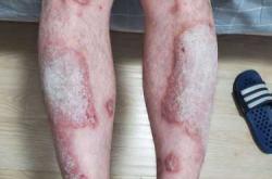 男用可善挺备孕能吗