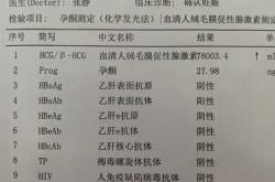 孕反一直恶心头晕正常吗