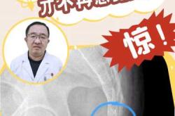 产后尾股疼是怎么回事