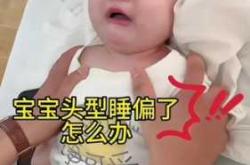 婴儿头睡偏了还能纠正过来吗