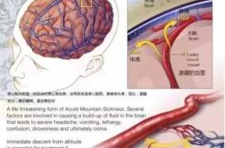 备孕高原反应有哪些症状