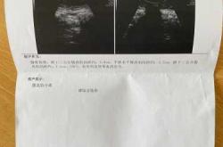 产后阴超什么时候做