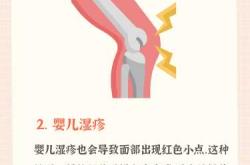 婴儿脸上起湿疹是怎么回事