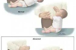 婴儿早产几个月能存活