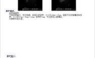 备孕能做乳腺N超吗