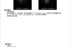 备孕能做乳腺N超吗