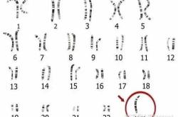 备孕中总梦到别人怀孕咋回事