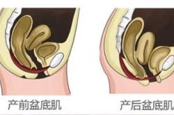 产后阴道水少是怎么回事