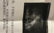 铅山县备孕照护是否收费