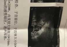 铅山县备孕照护是否收费