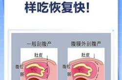 剖腹产不排气能吃饭吗