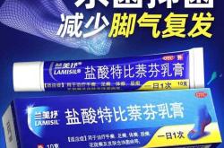 婴儿体癣用啥药膏效果好